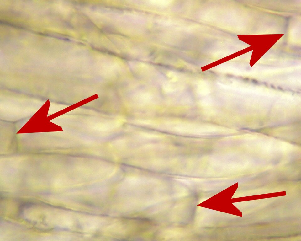 Fungal hyphae with septa