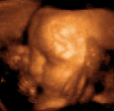 A picture of a fetus, aged 29 weeks, in a "3D ultrasound"