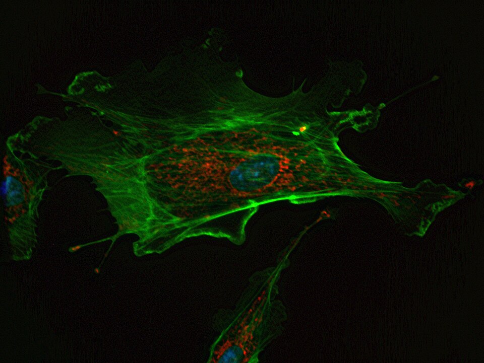 Endothelial cell: nuclei stained blue, mitochondria stained red, and F-actin, a component of microfilaments, stained green. Cell imaged on a fluorescent microscope.