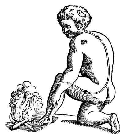 Illustration of how pain travels to the brain, from René Descartes's Treatise of Man