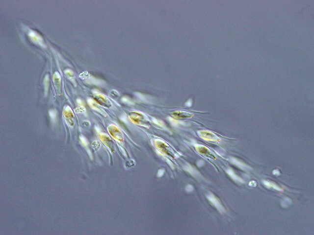 Dinobryon, a colonial alga from the Chrysophyceae group