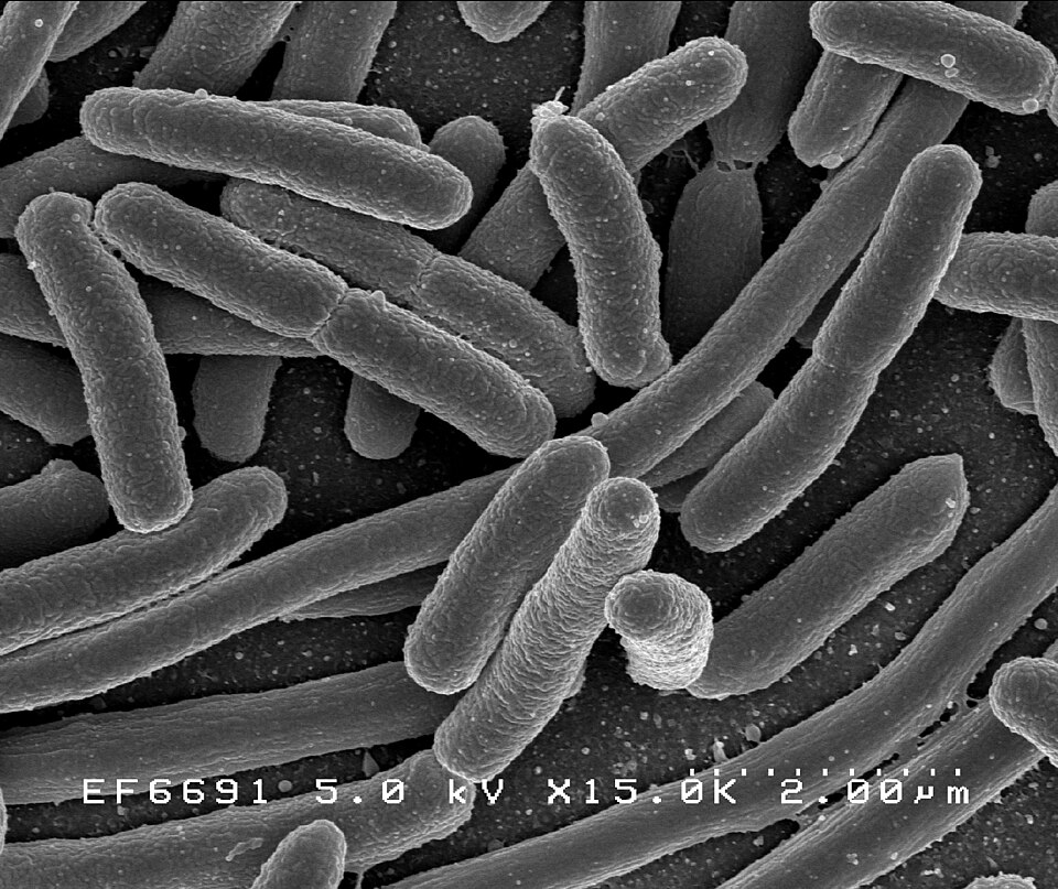 Bacteria (Escherichia coli cells magnified 25,000 times)