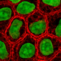 Cells in culture: The red is for keratin (skin) and the DNA neuclus has been stained green
