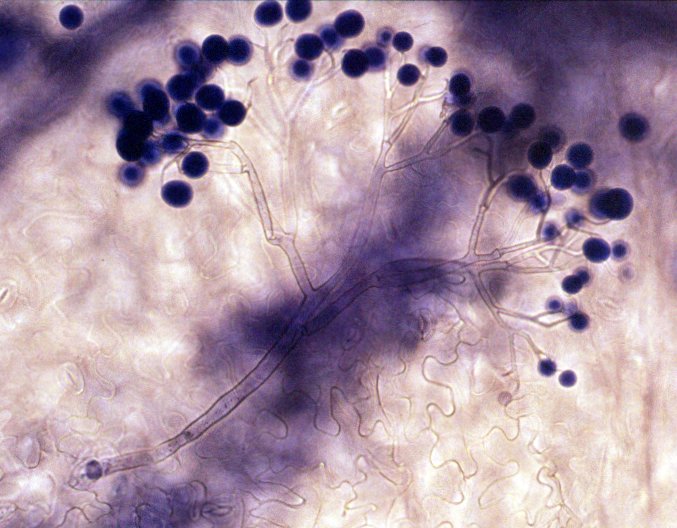 Conidiophore of Hyaloperonospora parasitica harboring several conidia
