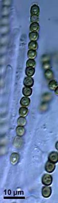 Ascus of Hypocrea virens with eight two-celled ascospores