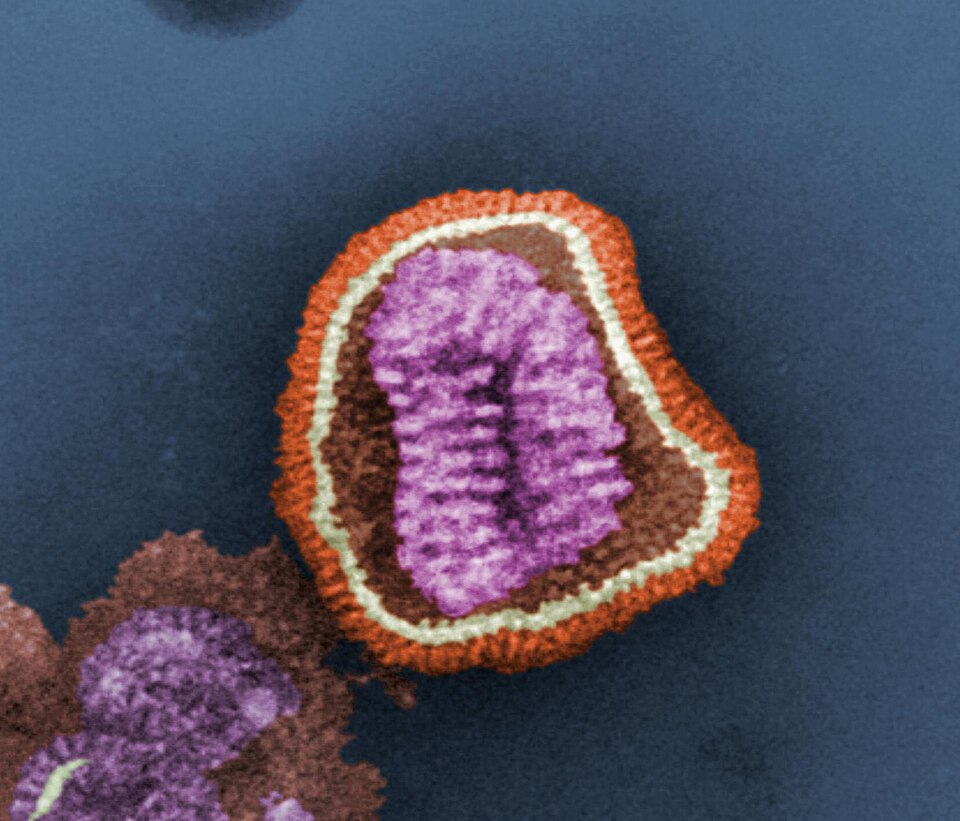 This false-coloured transmission electron micrograph depicts the ultrastructural details of an influenza virus particle, or “virion”. The influenza virus is a single-stranded RNA organism
