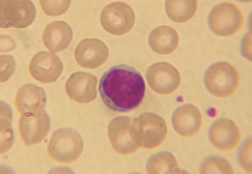 Lymphocyte (stained)