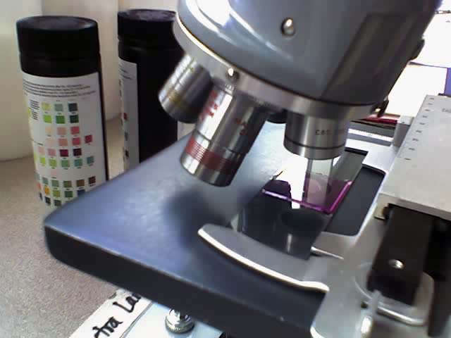 A stained histologic specimen, sandwiched between a glass microscope slide and coverslip, mounted on the stage of a light microscope.