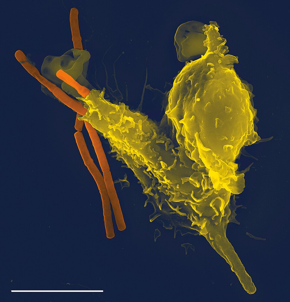 A scanning electron microscope photo of a single neutrophil (in yellow), engulfing some anthrax bacteria (in orange).