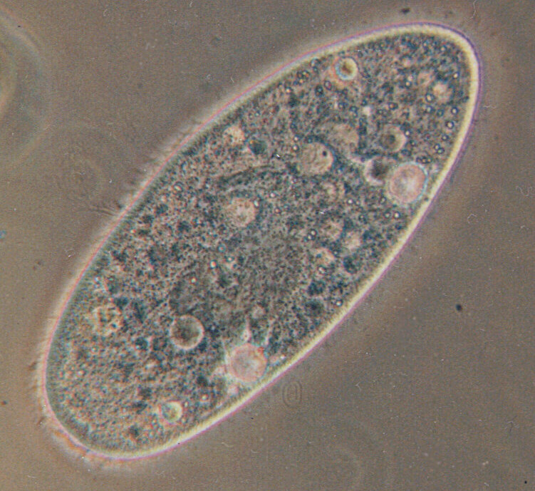A Paramecium, a single-celled organism