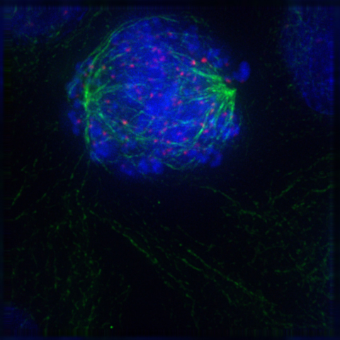 Early prometaphase: The nuclear envelope has gone, the microtubules interact with the kinetochores on the chromosomes