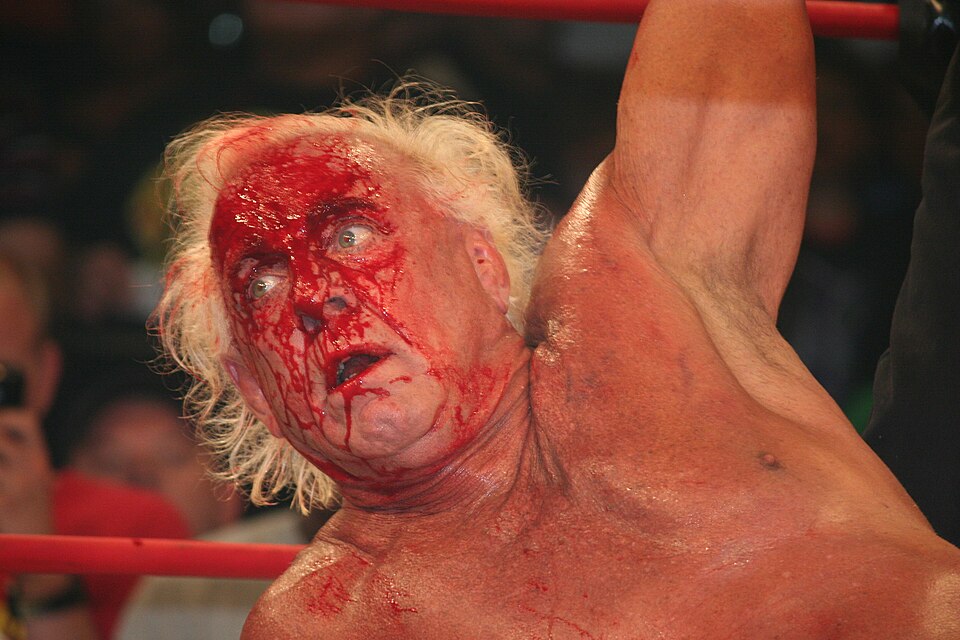 Ric Flair bleeding, 5th August 2010