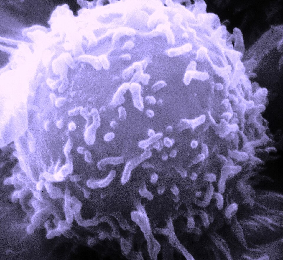 A scanning electron microscope (SEM) image of a single human lymphocyte.