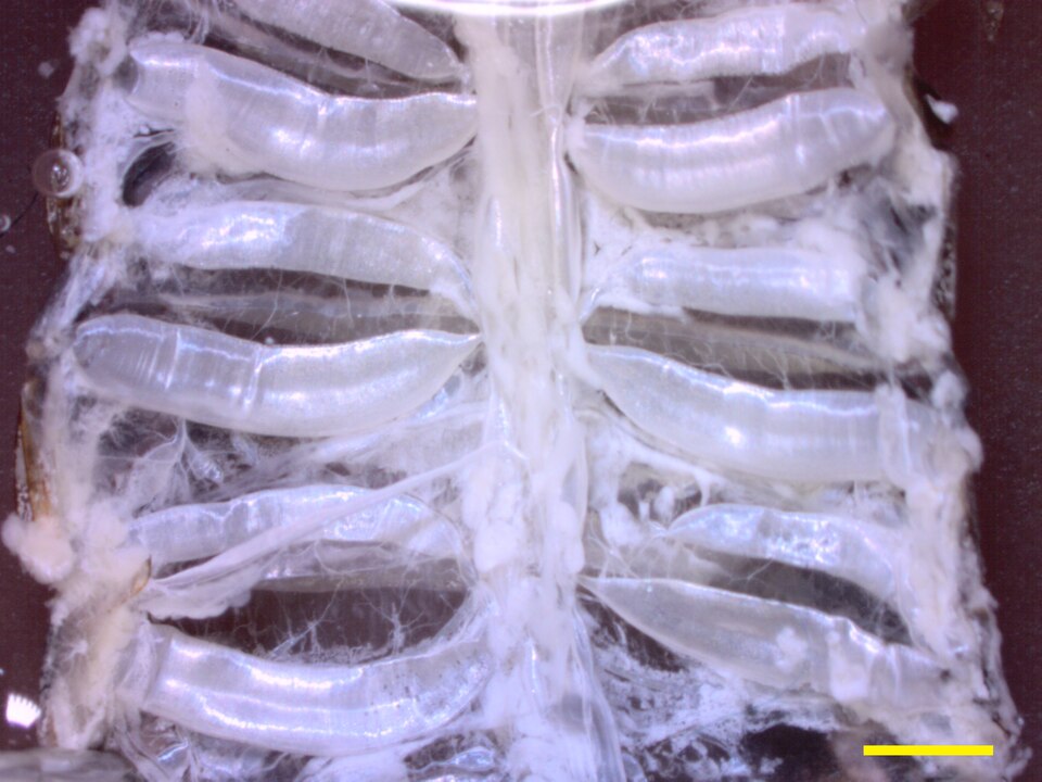 Tracheal system of a cockroach. The largest tracheae run across the width of the body and are horizontal in this image. Scale bar: 2 mm